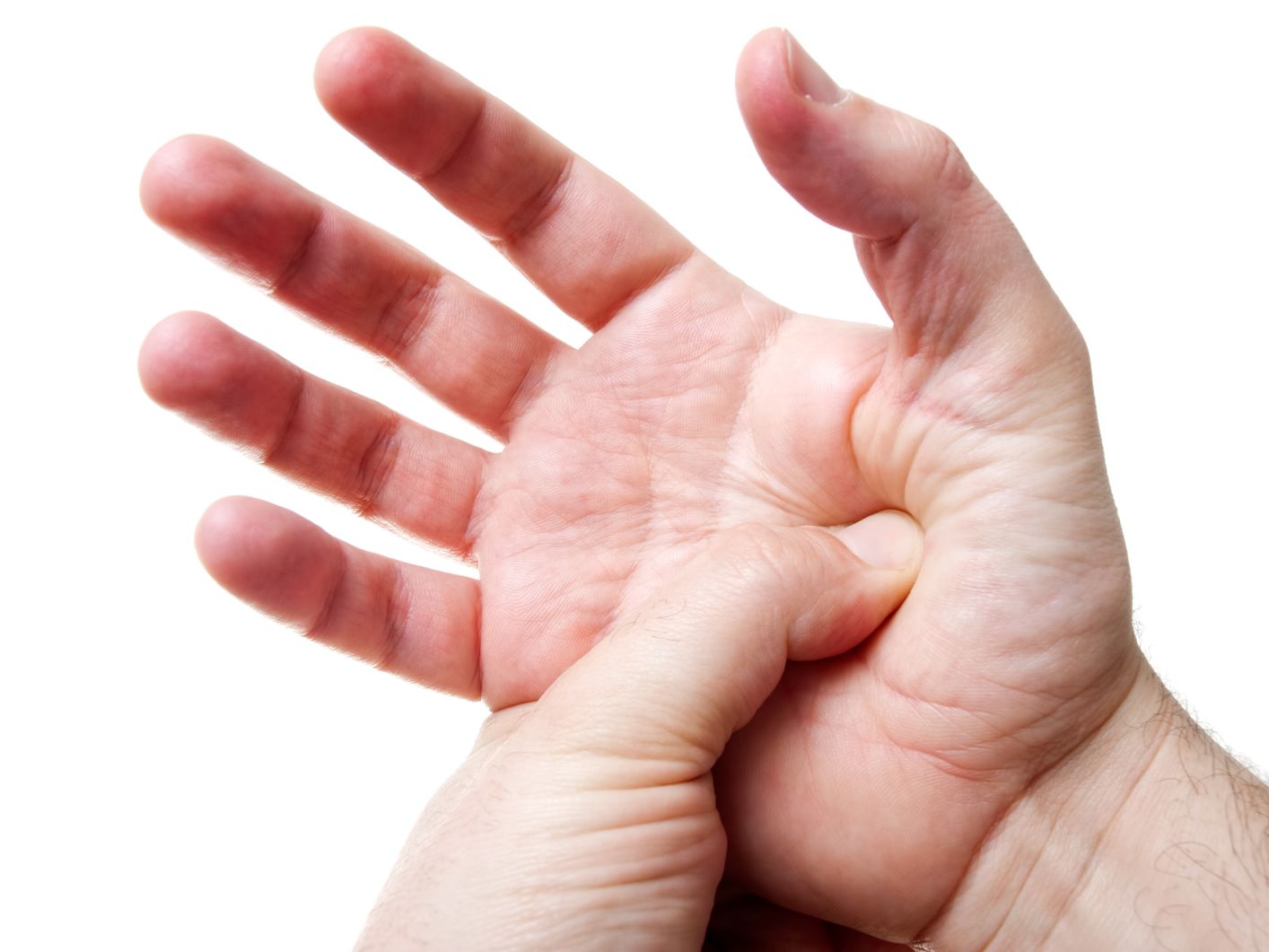 Avanti Acupuncture