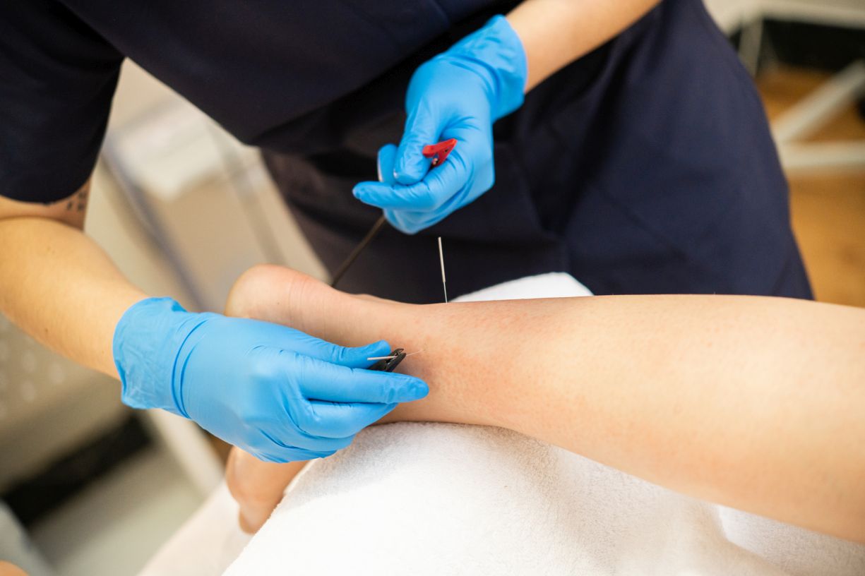 Avanti Acupuncture